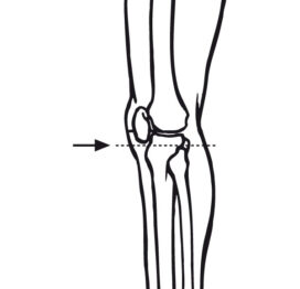 Measurement