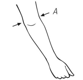 Elbow Measurement