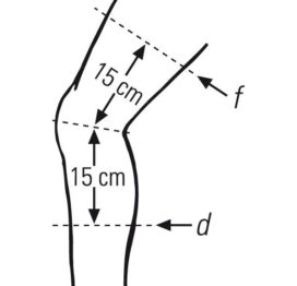 Knee- 2 point Measurement