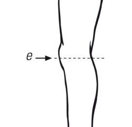Knee- 1 point Measurement