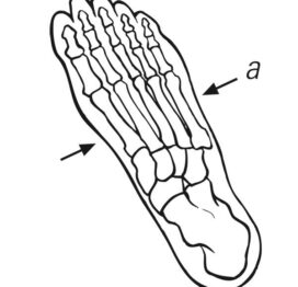 Metatarsal- Foot Measurement